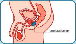 prostraat